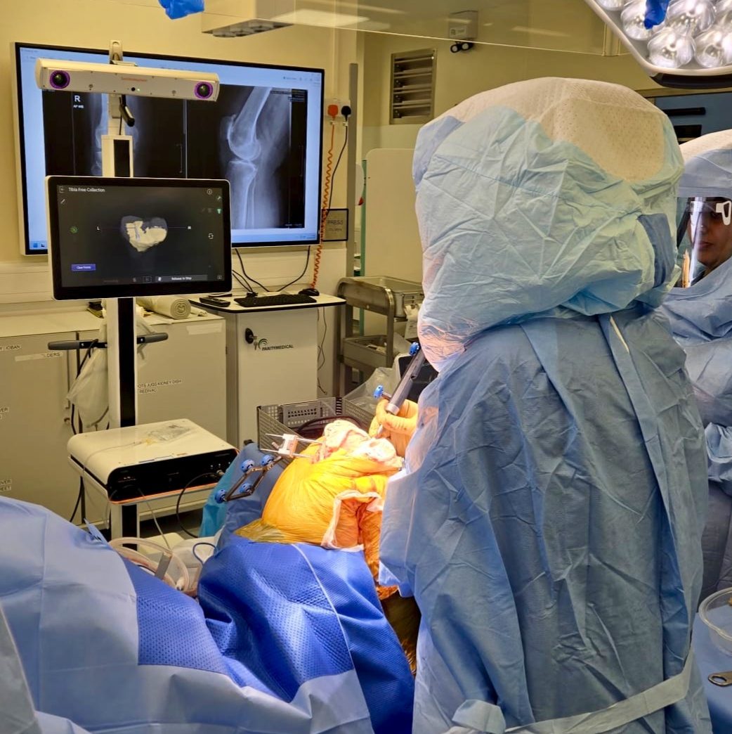 Surgeon collecting tibial surface data during CORI robotic knee replacement surgery in Birmingham