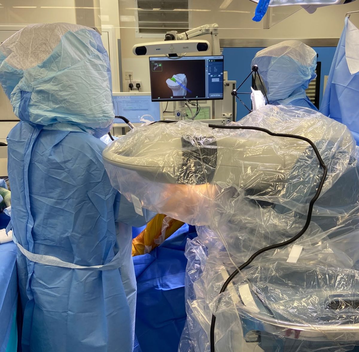 Robotic arm and 3D planning screen used during robotic-assisted knee replacement surgery in Birmingham