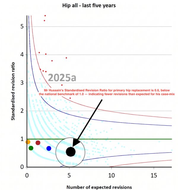 NJR funnel plot showing Mr Shakir Hussain's hip replacement revision rate well below the national average — a Standardised Revision Ratio of 0.6, giving patients 40% fewer revisions than expected. Mr Hussain performs hip replacement and hip resurfacing surgery in Birmingham at the Royal Orthopaedic Hospital.