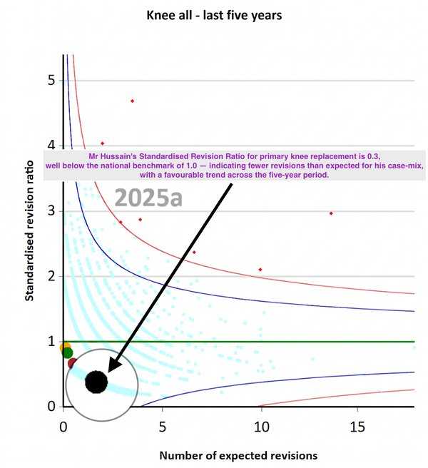 NJR funnel plot showing Mr Shakir Hussain's knee replacement revision rate far below the national average — a Standardised Revision Ratio of 0.3, giving patients 70% fewer revisions than expected. Mr Hussain performs robotic knee replacement surgery in Birmingham at the Royal Orthopaedic Hospital.