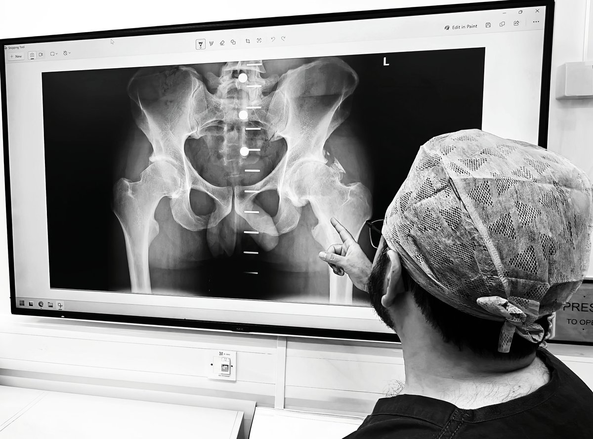 Mr Shakir Hussain, consultant hip surgeon in Birmingham, studying a pelvic X-ray while planning hip replacement surgery